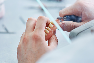 入れ歯は作成後も定期的な調整が大切です